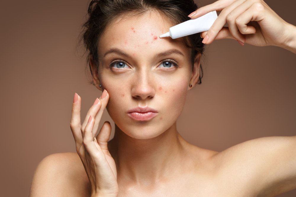 Acne-Pimples Skin Care Gels/ serums